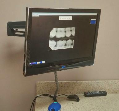 Рентгеновские снимки зубов. Фото Свободно для коммерческого использования, Атрибуция не требуется. Бесплатное стоковое фото для свободного скачивания