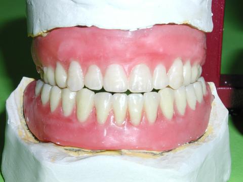 Вставные зубы. Фото Свободно для коммерческого использования, Атрибуция не требуется. Бесплатное стоковое фото для свободного скачивания