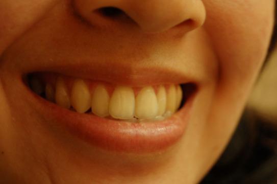Зубы. Фото Free for commercial use, No attribution required. Бесплатное стоковое фото для свободного скачивания